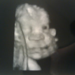 4D-sonogram